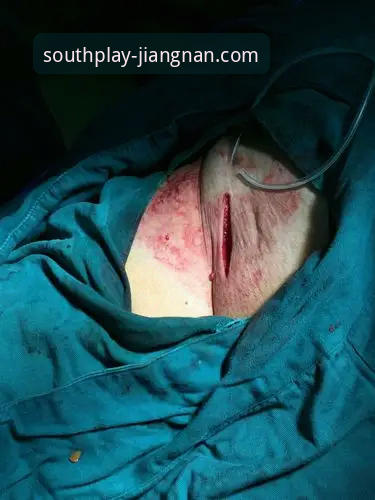 贝里瓦尔腹股沟挡射门vs手术室三条韧带：世界杯梦想与体育精神的热血对决